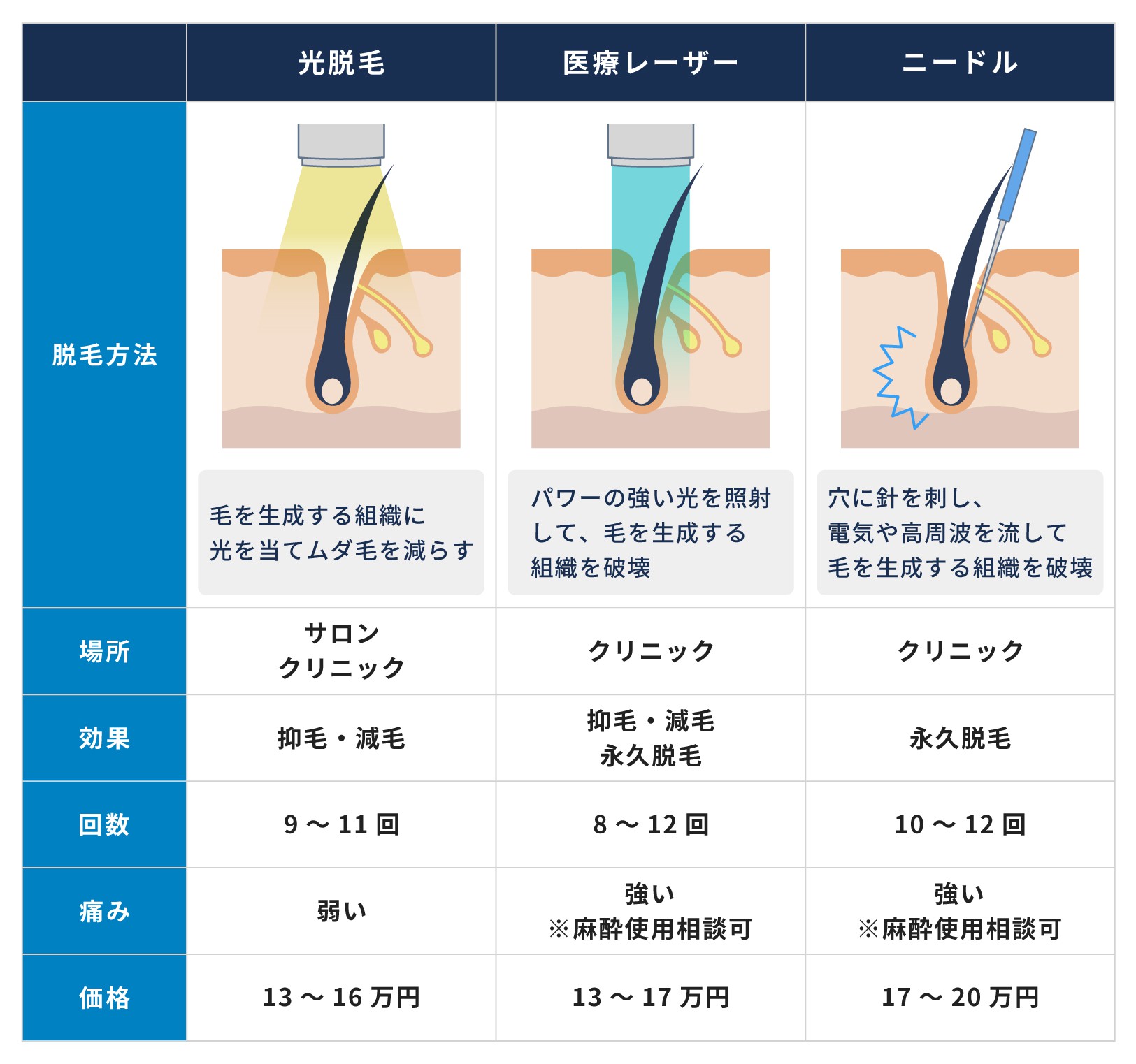 高槻おすすめメンズ医療脱毛10選！VIOや顔が安い人気クリニックを徹底調査｜表参道・南青山の高級脱毛メンズクララクリニック