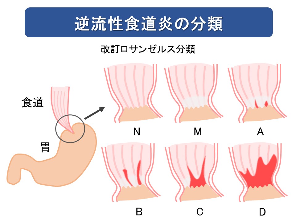 公式】大阪ヘルス 痴女M性感（風俗）梅田ゴールデン倶楽部