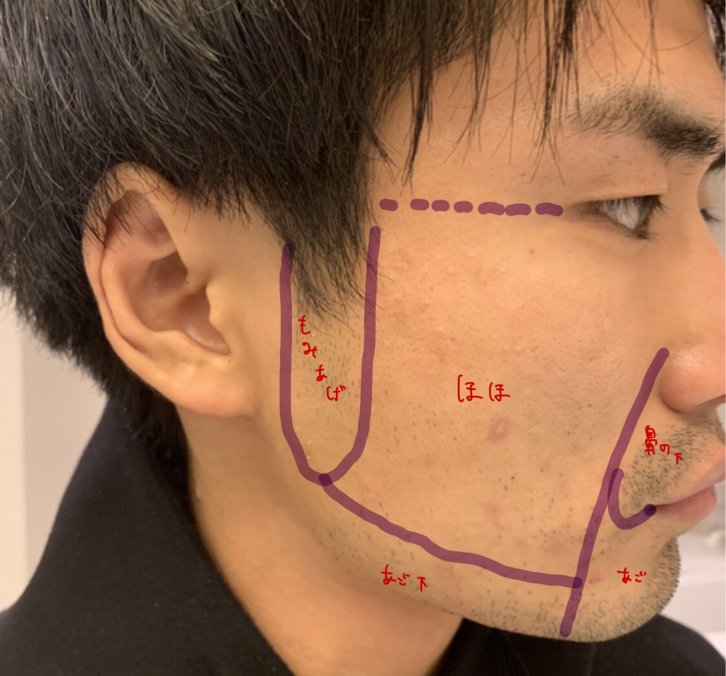 ヒゲを抜く時の痛みについて、個人の感想 | 毛抜き職人のブログ