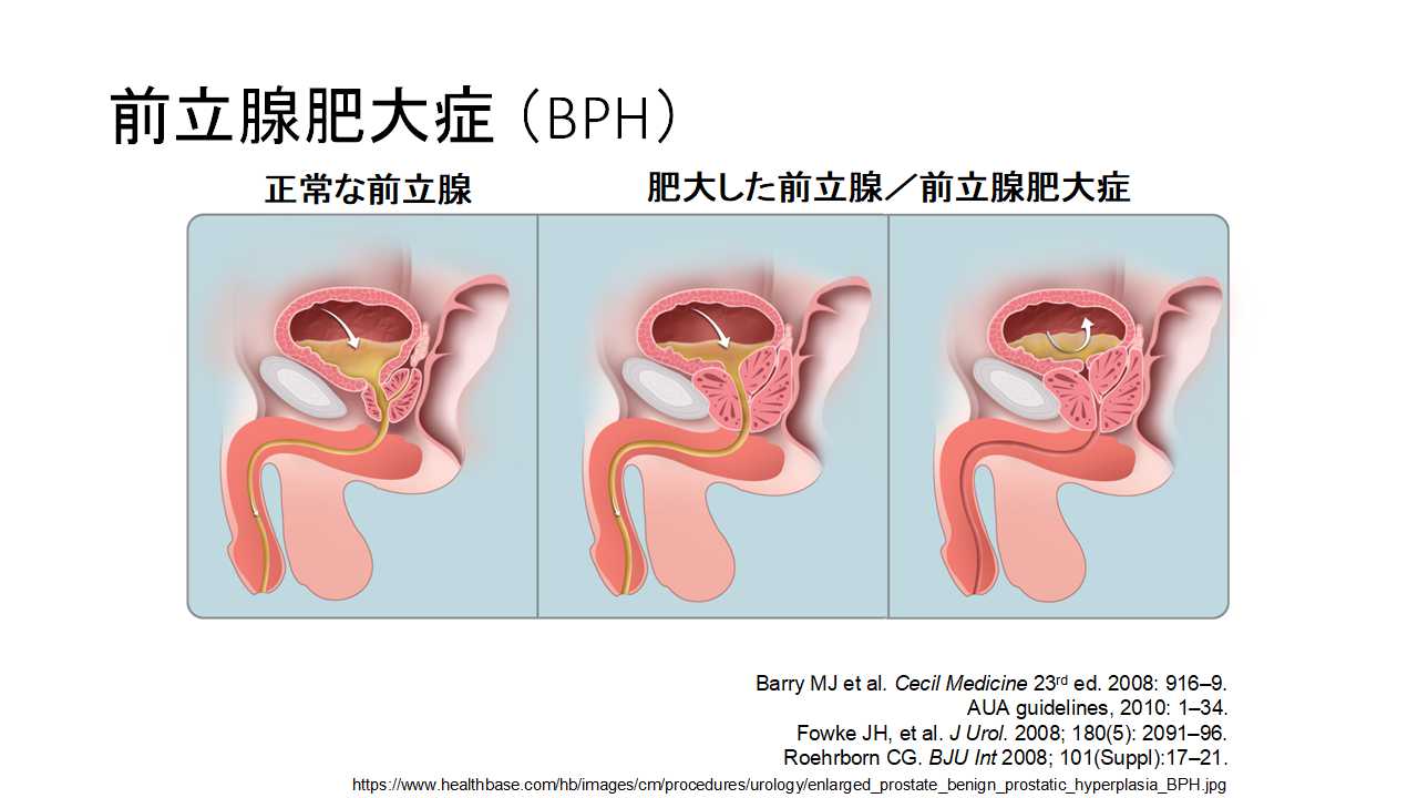 男性の“Gスポット”を探るための前立腺マッサージ4ステップ｜メンズヘルス公式