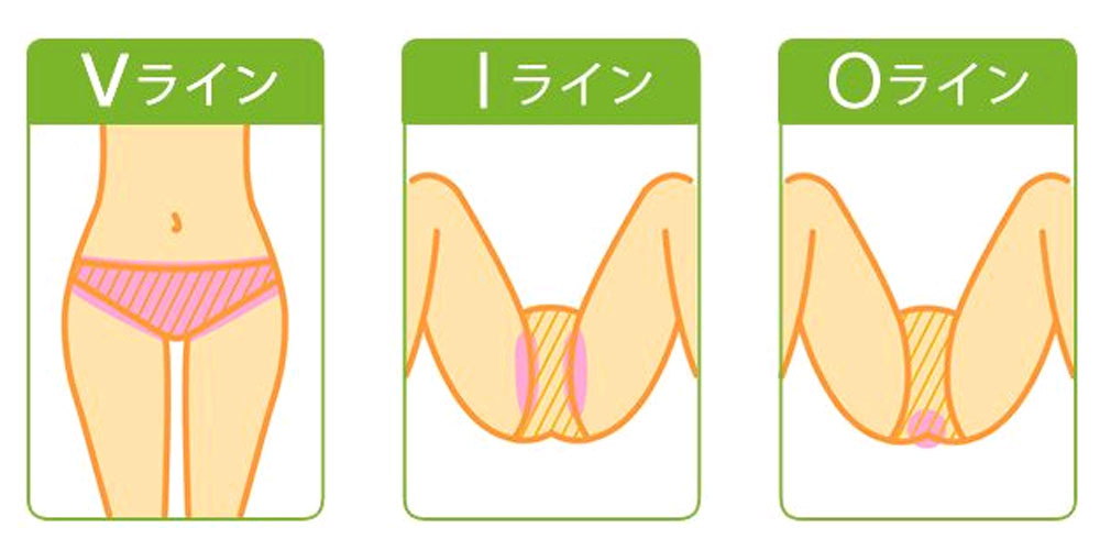 女性必見】パイパンってドン引き？ヤリマンと思われる？