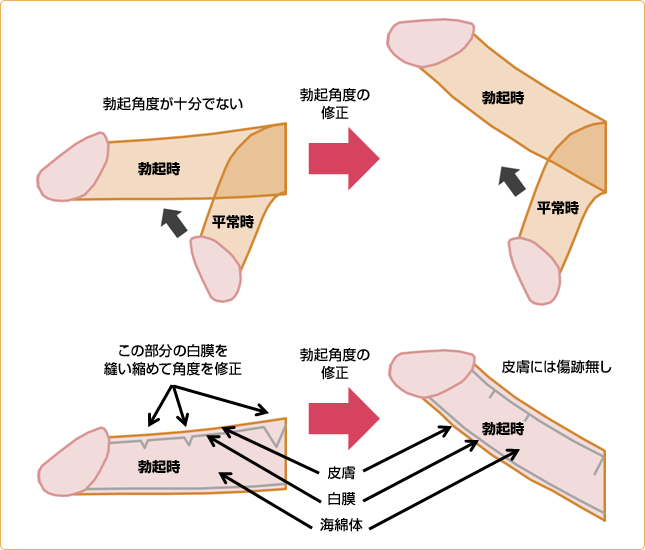 上反りちんこが女性を中イキさせる理由を画像でわかりやすく解説｜裏垢男子で年収2000万