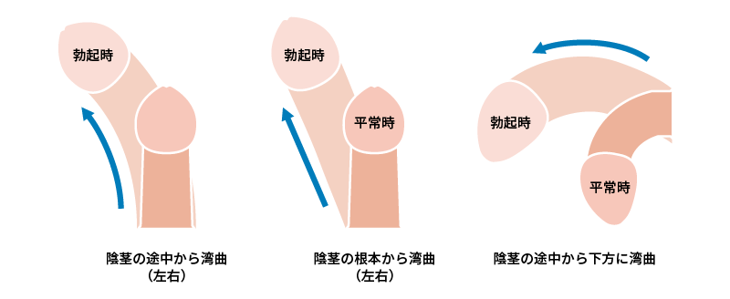 ヨドバシ.com - ペニスの王子様 中（辰巳出版） [電子書籍]