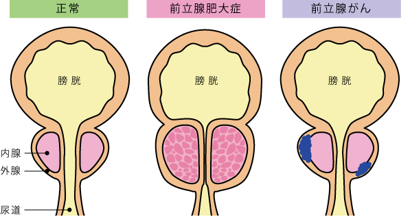 前立腺責めのやり方とコツ！気持ちいい前立腺マッサージの方法をイラストで解説