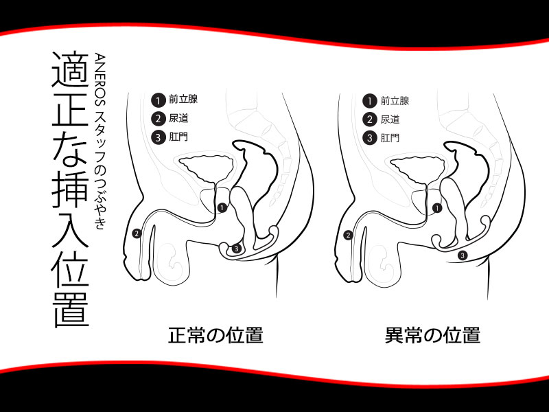 ドライオーガズムとPC筋の感覚 | アネロスジャパン |