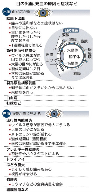 医師監修】キスで感染する！伝染性単核球症（キス病）の症状と潜伏期間、感染経路を解説 - ルナレディースクリニックのメディア