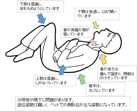 介護 クッション MOGU ポジショニングに便利な筒型クッション 使い勝手のよいシンプルな筒型クッション介護用 クッション 介護用のクッション体位変換 看護 側臥位 仰臥位 座位 体勢 入院 寝たきり 腕 肘 ひじ 膝 ひざ ミニクッション枕と眠りのおやすみショップ