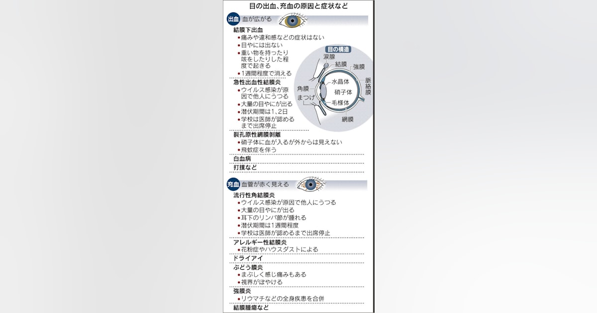 梅毒とはどんな病気？感染経路や症状、検査方法や治療をすれば治るのか徹底解説 - Hit The