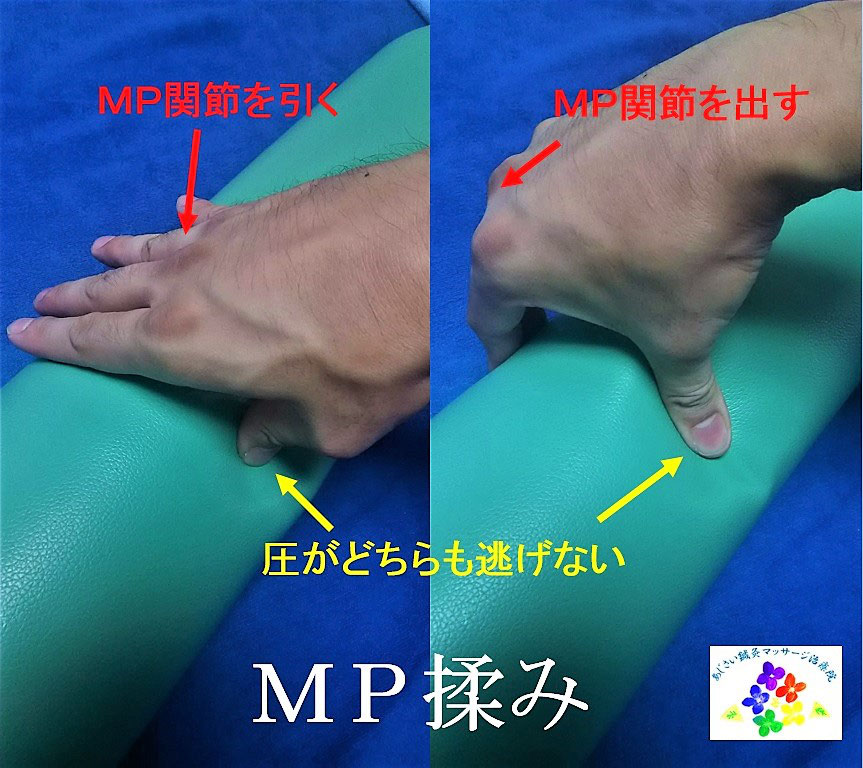 按摩の話 線状揉捏と母指揉捏～ -  東京都新宿区牛込柳町駅そばにある鍼灸マッサージ院。子育てママさんの味方。小さなお子さん連れでも入れます。社交ダンス選手のために社交ダンスに特化したコースがあります。｜