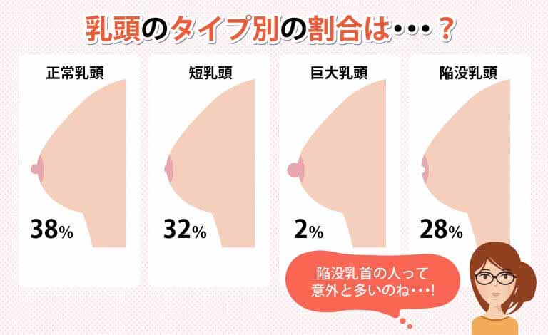 豊胸・人工乳腺の症例写真 | 豊胸・豊胸手術なら城本クリニック