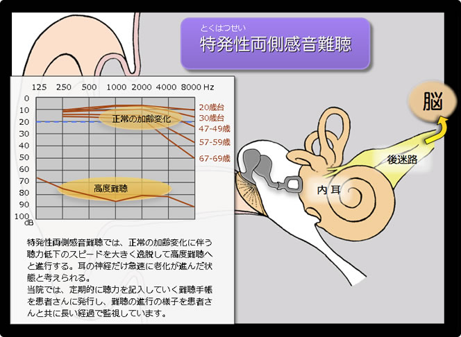 聞こえのしくみ - 聞こえに困っている方へ -