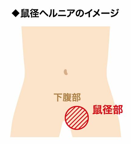 ママさん必見！！】骨盤矯正について｜佐賀市で骨盤矯正をするならうちだ整骨院へ | 佐賀市の整骨院ならうちだ整骨院へ