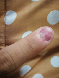 歯の色を綺麗にして好印象に！自宅でも簡単に手入れする方法！ホワイトニングサロンKiratt