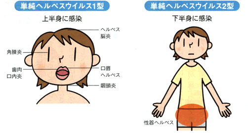 淋病（淋菌感染症）の原因｜淋菌はどこからくるの？うつる確率は？ | 泌尿器科｜GOETHE メンズクリニック東京駅