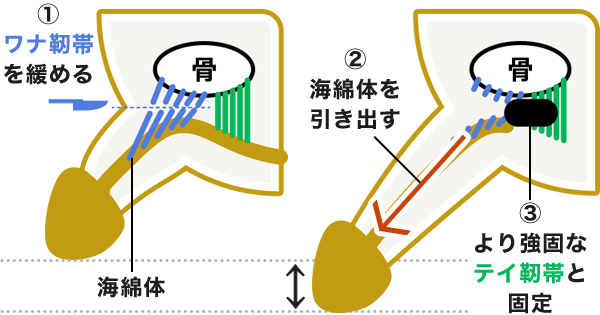 短小包茎とは！短小は何センチから？日本人の平均サイズや治療法 - アトムクリニック