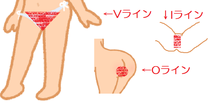 VIOの正しい自己処理方法！ツルツルにするやり方は？必須グッズ・手順も紹介