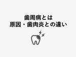 保険で出来る奥歯の白いかぶせもの（白い歯）、ＣＡＤ/ＣＡＭ(キャドキャム)冠について ※令和６年６月更新 | 佐々木歯科医院