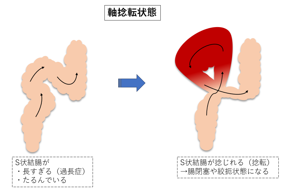 大腸がん】高い生存率を支える薬物療法の進歩 | ファーマスタイル