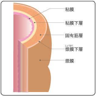 腹腔鏡下S状結腸切除術ハンズオントレーニング[DVD付]: 動画でわかる徹底レクチャー | 伊藤 雅昭,