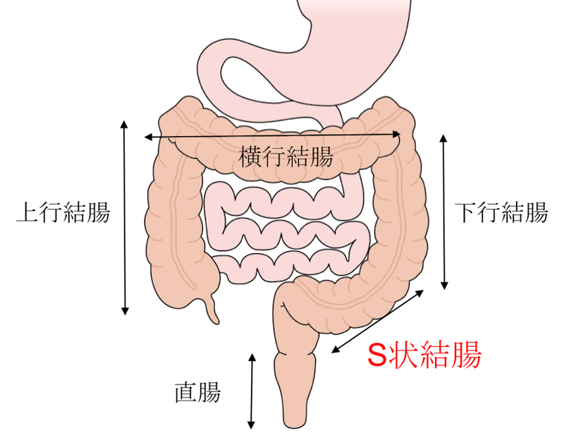 JSCCR | 大腸癌研究会