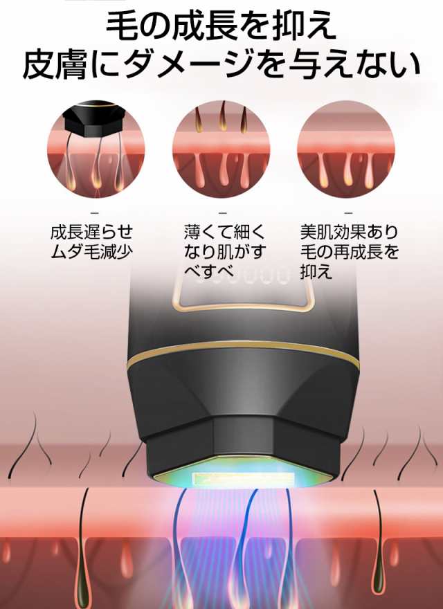 仙台の脱毛サロンおすすめ5選！全身・VIO脱毛が安い・都度払いができるサロンを紹介 | 脱毛コラム｜【STLASSH公式】